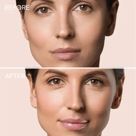 MAREE Amazon Lip