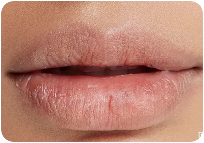 Before using Maree Instant Dark Circle Corrector Balm