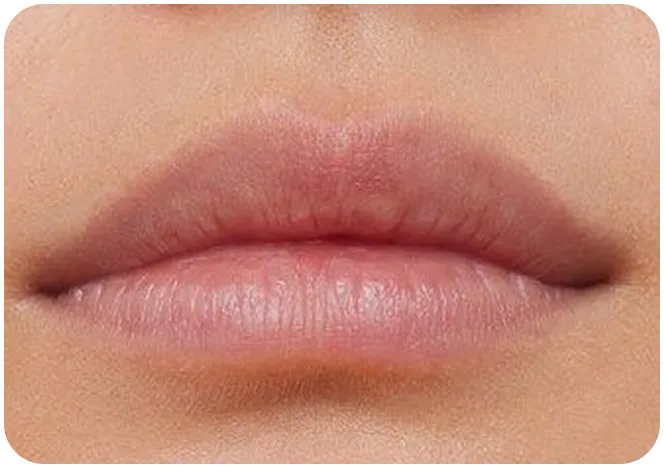 After 1 week using Maree Instant Dark Circle Corrector Balm
